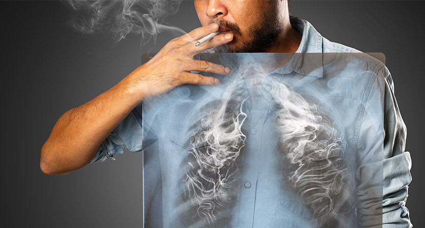 Un fumeur détériore ses poumons. Mais, en arrêtant, ils sont capables de se régénérer !